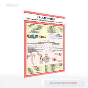 Плакат «Первая помощь при сдавливании» обычно имеет целью обеспечить информативное и наглядное пособие по медицинской помощи при сдавливающих травмах. Такой плакат часто можно увидеть в общественных местах, рабочих площадках.