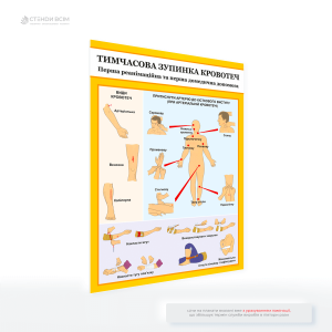 Інформаційний плакат домедичної допомоги «Тимчасова зупинка кровотечі», який є незамінним елементом у місцях на підприємстві, де можливі травми, і призначений для того, щоб кожен міг діяти оперативно й правильно в критичних умовах.