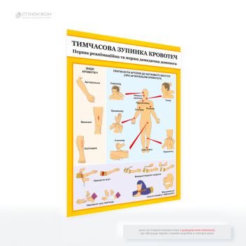 Інформаційний плакат домедичної допомоги «Тимчасова зупинка кровотечі», який є незамінним елементом у місцях на підприємстві, де можливі травми, і призначений для того, щоб кожен міг діяти оперативно й правильно в критичних умовах.