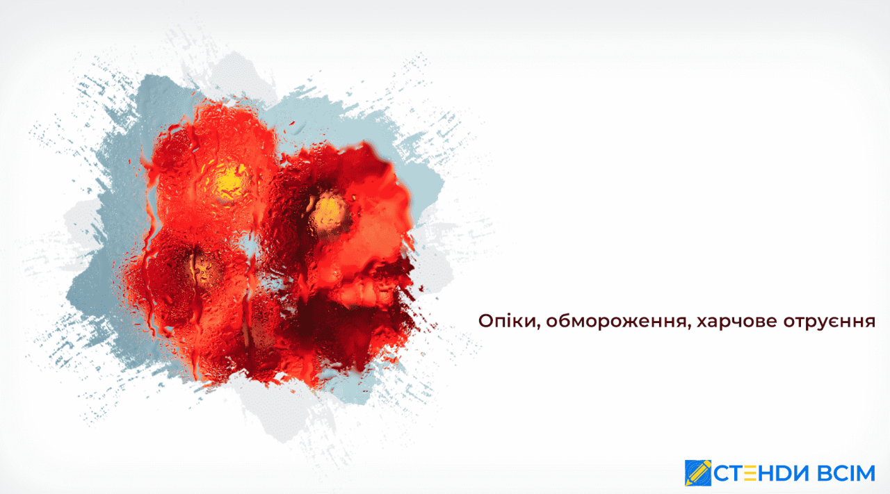 Ожоги, обморожение, пищевое отравление