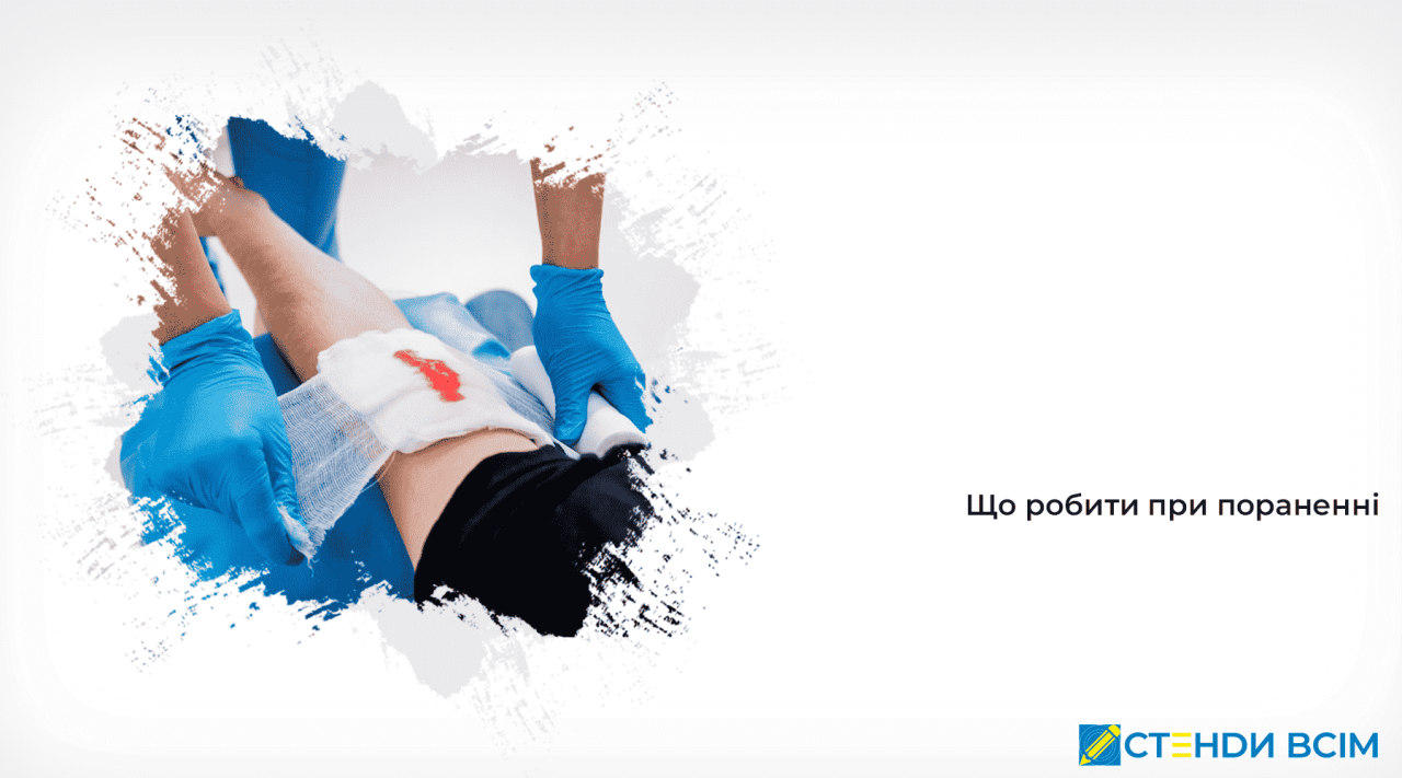 Що робити при пораненні