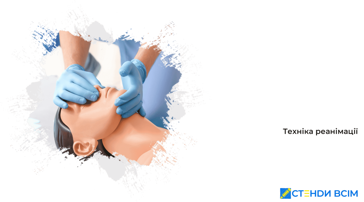 Техніка реанімації