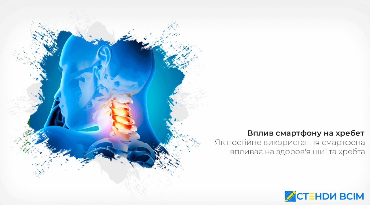 Вплив смартфона на хребет