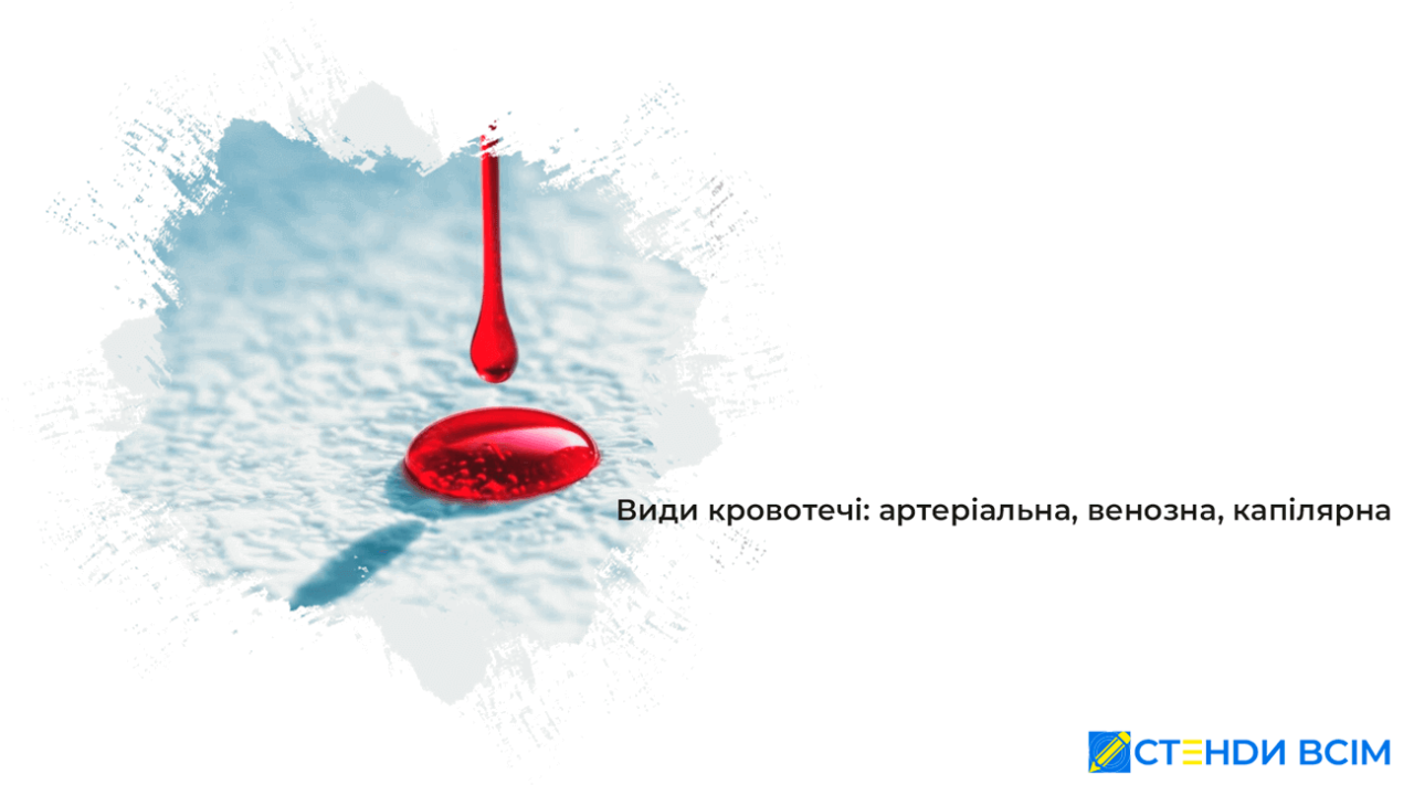 Види кровотечі