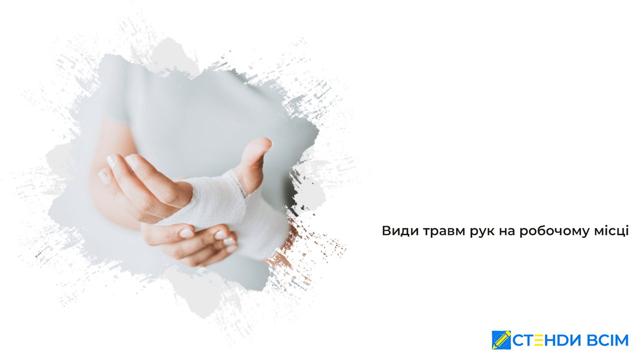 Види травм рук на робочому місці